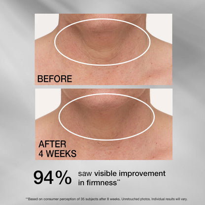 Corerslim® Tightening Neck Cream PLUS