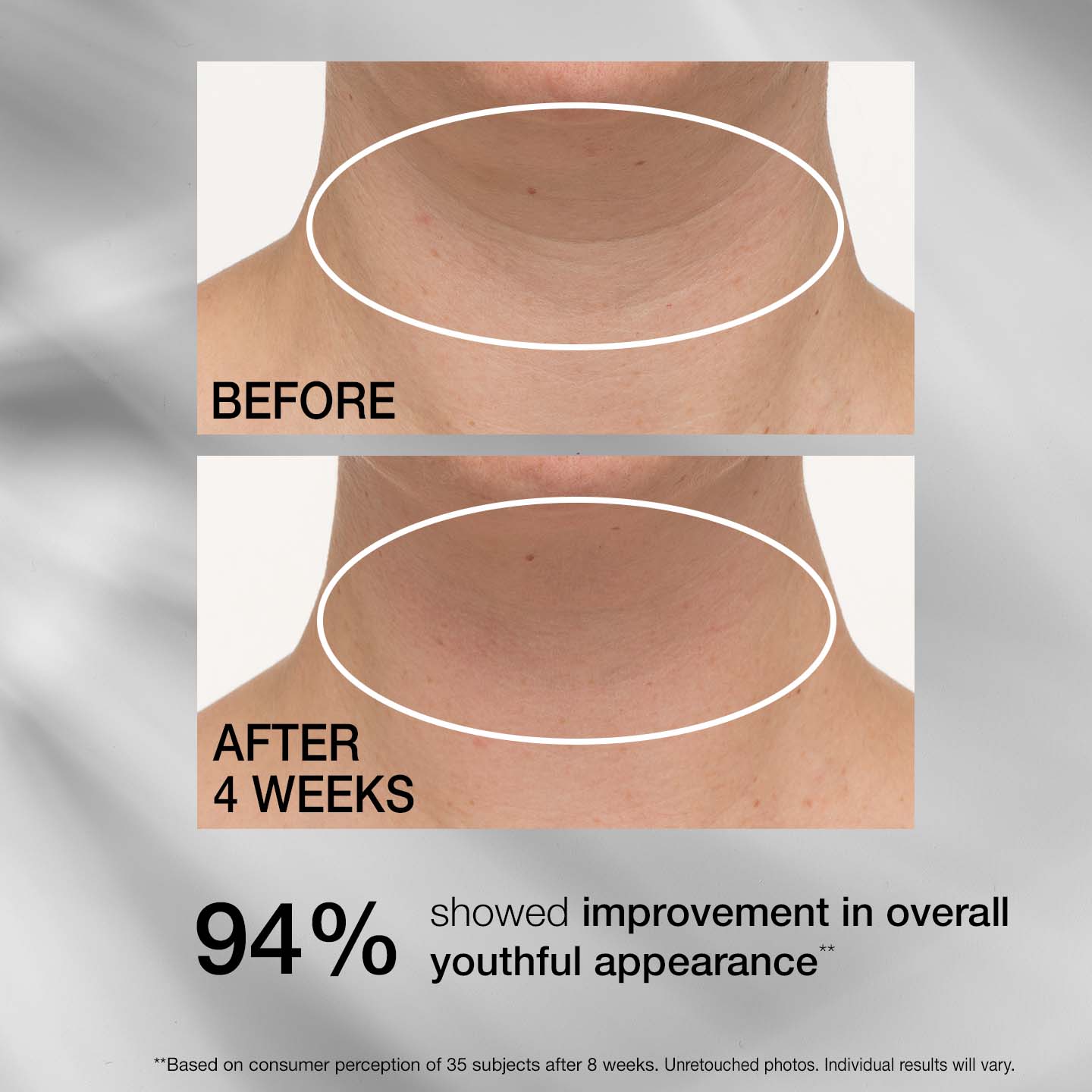 Corerslim® Tightening Neck Cream PLUS