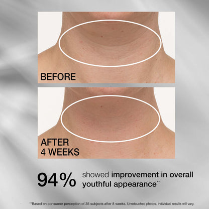 Corerslim® Tightening Neck Cream PLUS