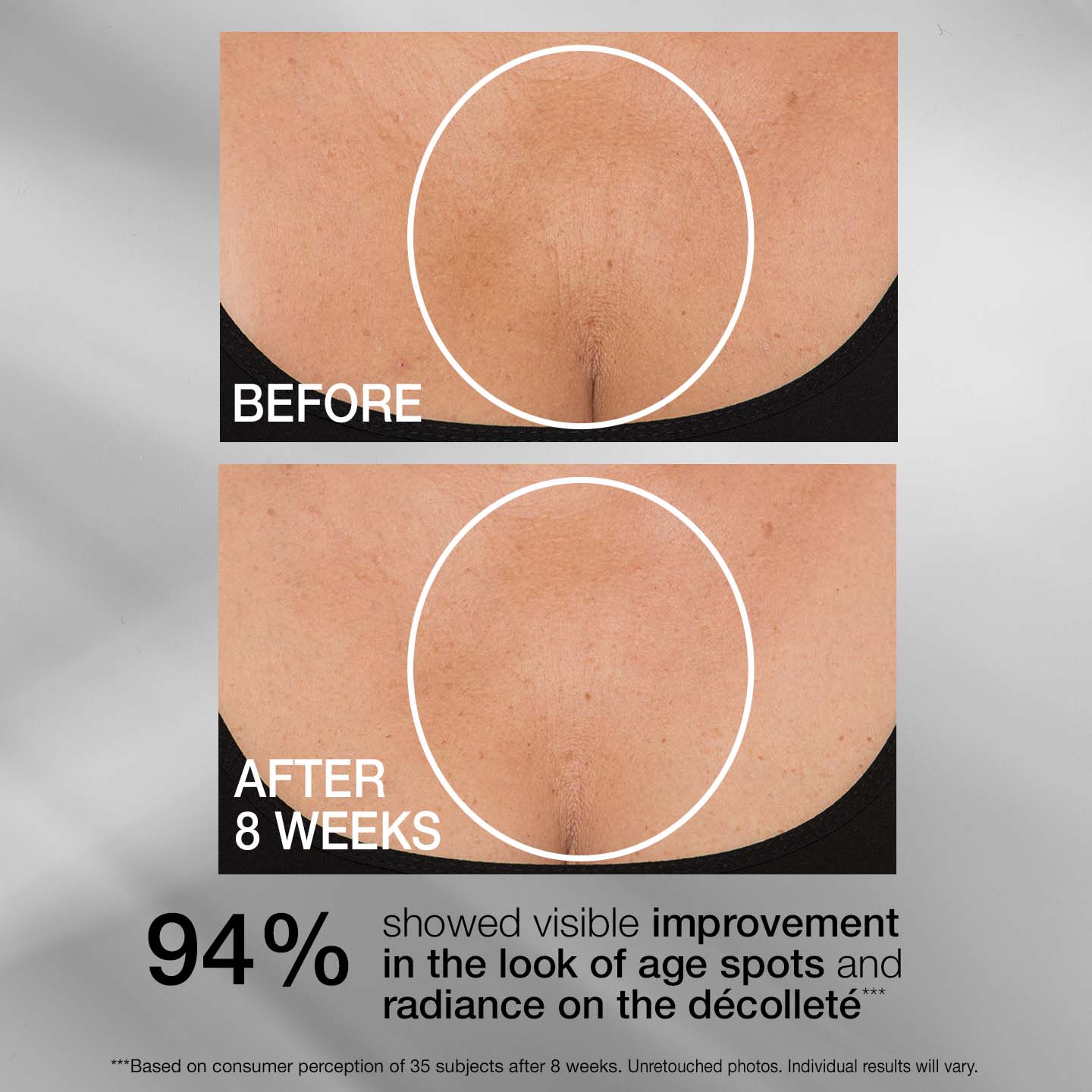Corerslim® Tightening Neck Cream PLUS
